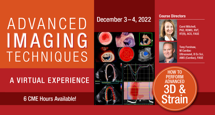 Russia Savant Temptation American Society of Echocardiography – Organization of professionals committed to excellence in cardiovascular ultrasound Russia Savant Temptation American Society of Echocardiography – Organization of professionals committed to excellence in cardiovascular ultrasound