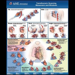 Comprehensive TTE Guideline Flip Chart Poster Bundle (4 Flip Chart Posters)