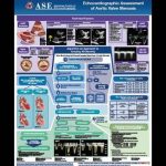 Guideline Flip Chart: Valve Poster Bundle (Set of 4)