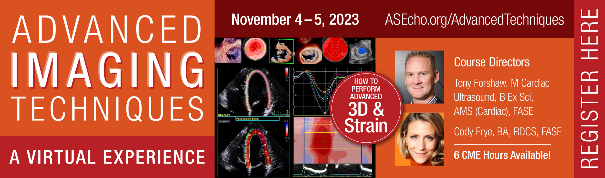 Principles and Practical Aspects of Strain Echocardiography