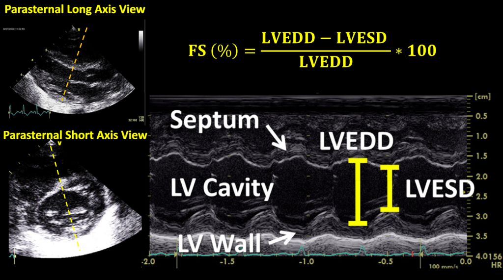 Guidelines and Recommendations for Targeted Neonatal Echocardiography and Cardiac Point-of-Care Ultrasound in the Neonatal Intensive Care Unit