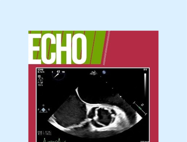 Hypertrophic Cardiomyopathy - ASE