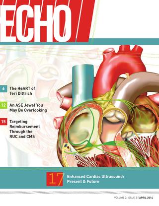 2014AprEchoCover-1