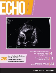 Echo-Magazine-April-Cover