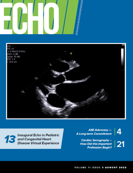 Echo Magazine August 2022 – ASE
