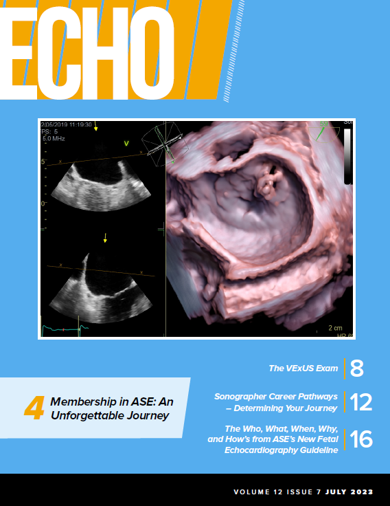 July-Cover-Echo-Mag