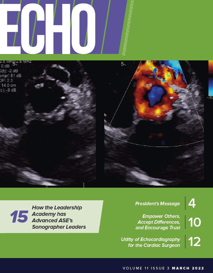 March-issue-of-Echo-1
