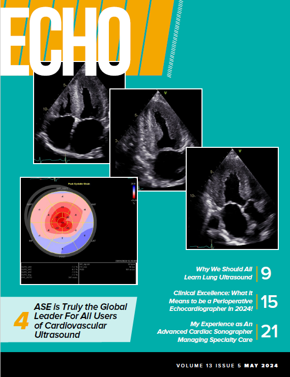May-Echo-Magazine-Cover-2024