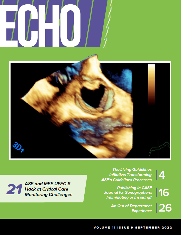 September-Echo-Magazine-cover