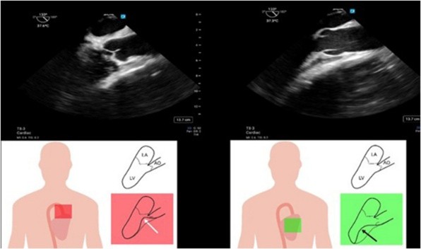 May 2025 CASE Image