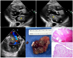 March 2025 CASE image