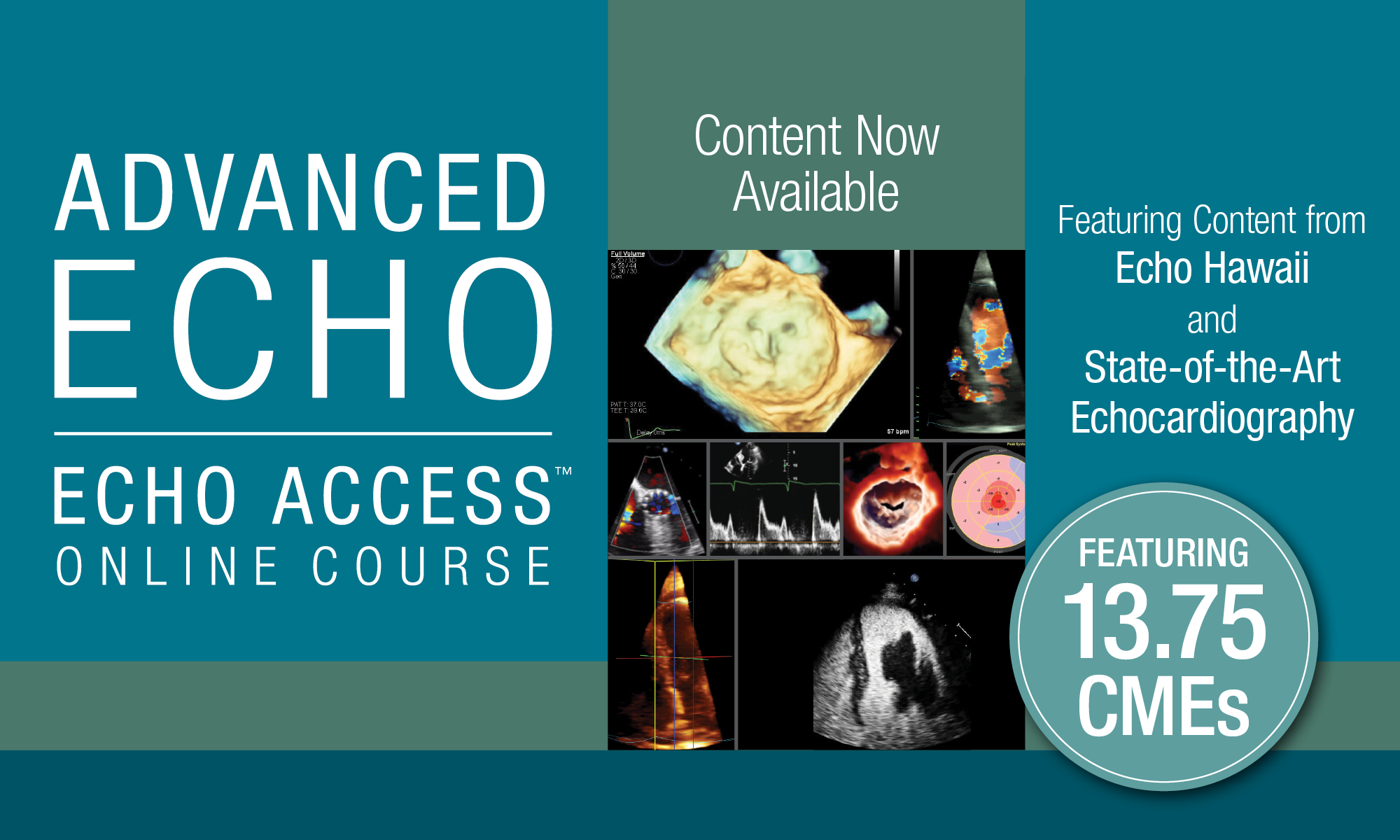 Advanced Echo 2025