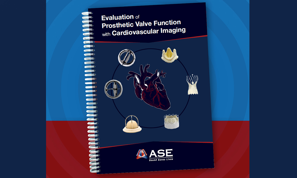 Evaluation of Prosthetic Valve Function with Cardiovascular Imaging