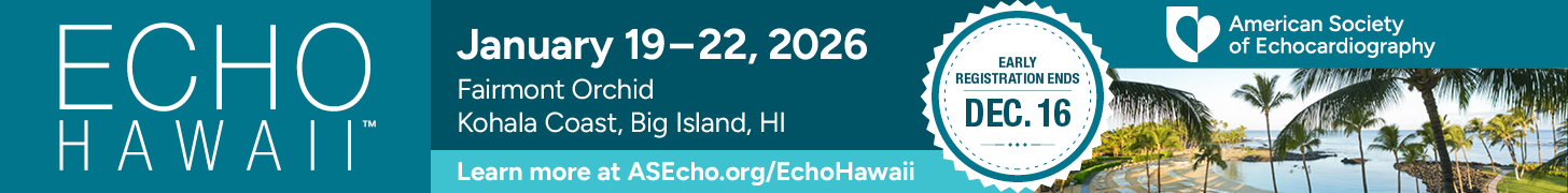 Echo Hawaii