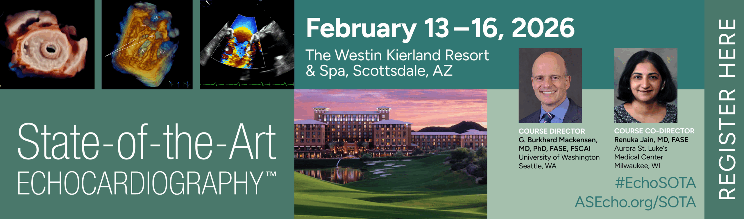 ASE-4608_2026 SOTA-Register Today_1542x454_r3