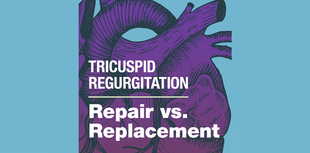 Tricuspid Regurgitation: Repair vs. Replacement