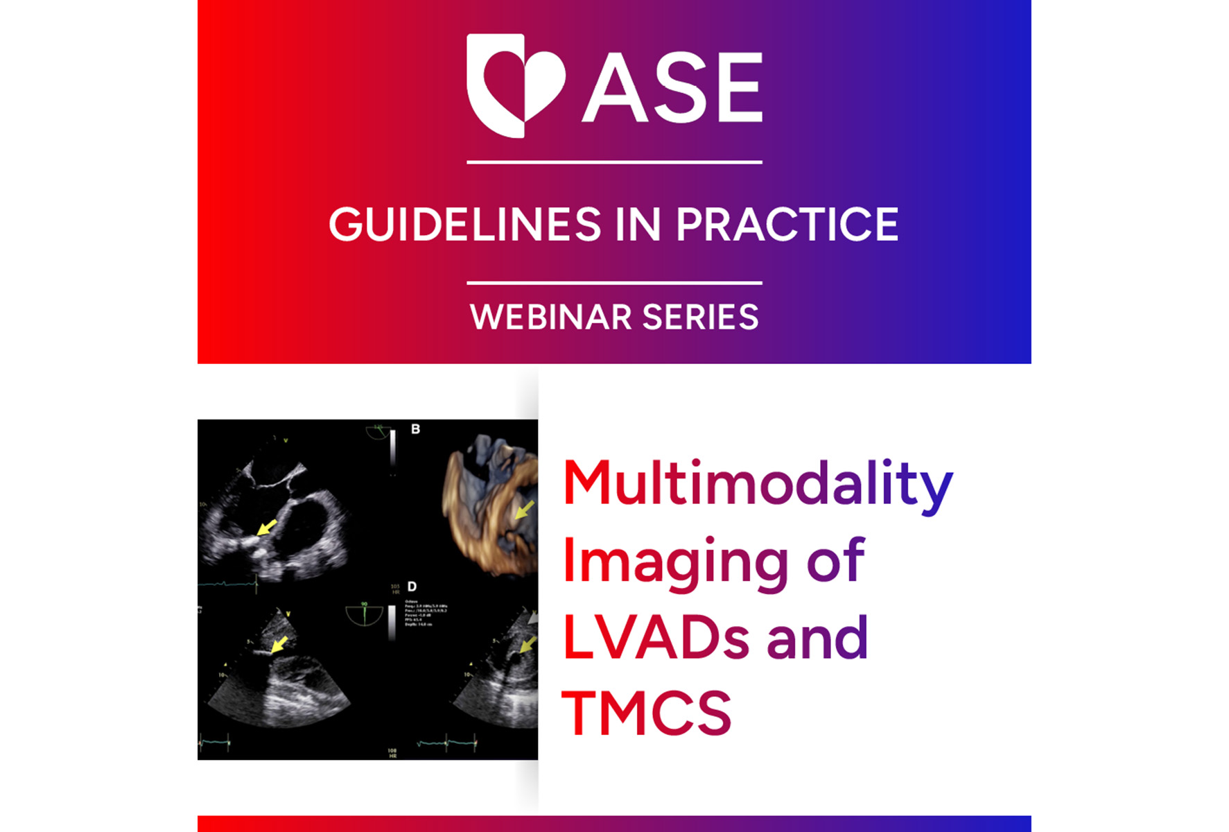 Guidelines in Practice Webinar Series: Multimodality Imaging of LVADs and TMCS