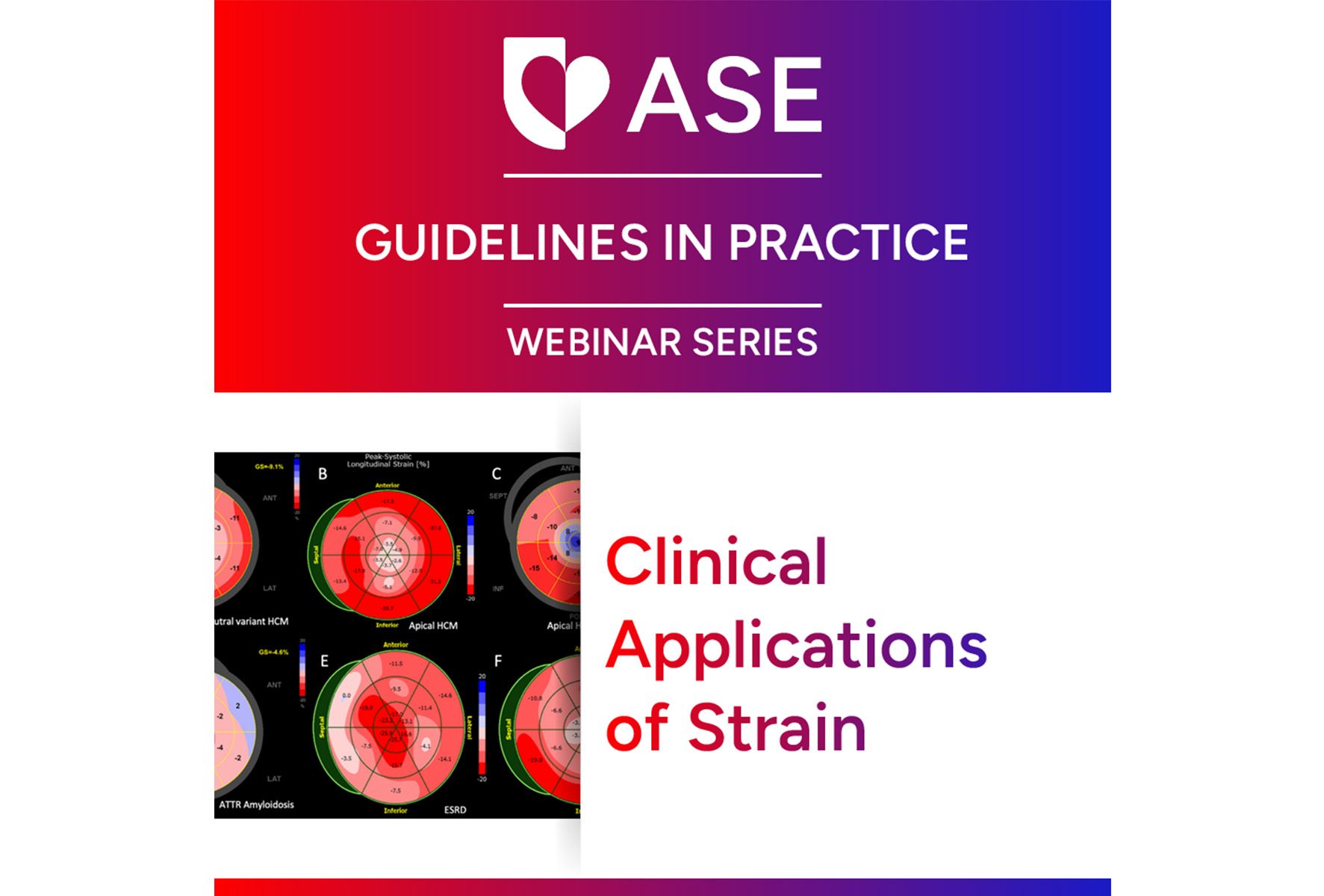 Guidelines in Practice Webinar Series: Clinical Applications of Strain