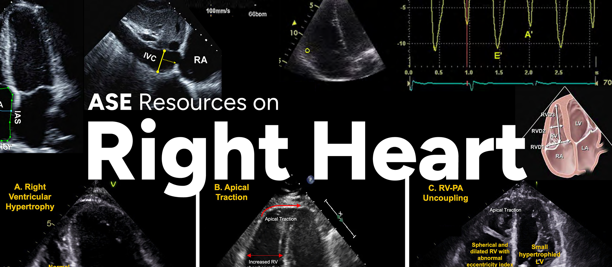 ASE's Resources on Right Heart