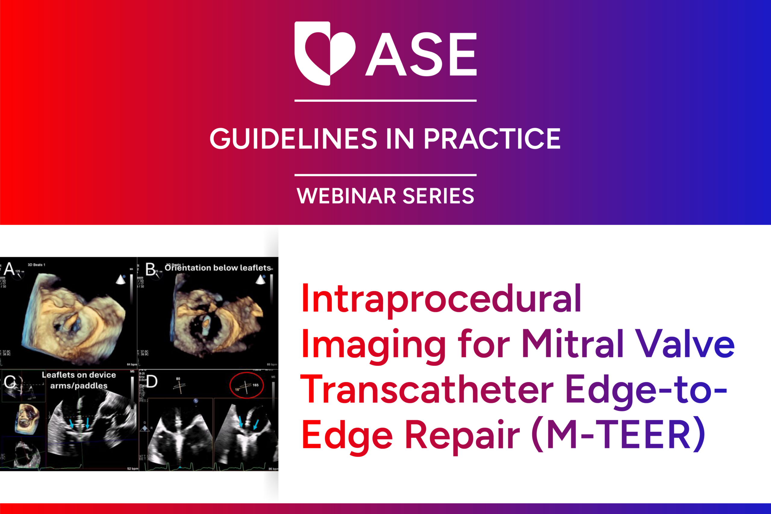 Intraprocedural Imaging for Mitral Valve Transcatheter Edge-to-Edge Repair (M-TEER)
