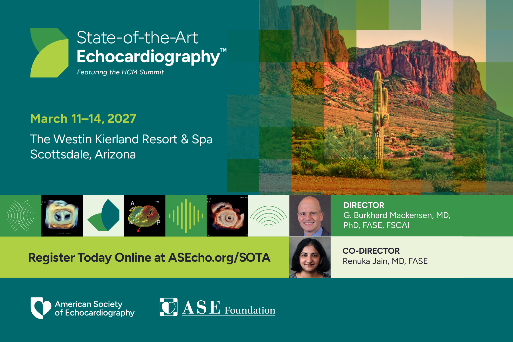 State-of-the-Art Echocardiography