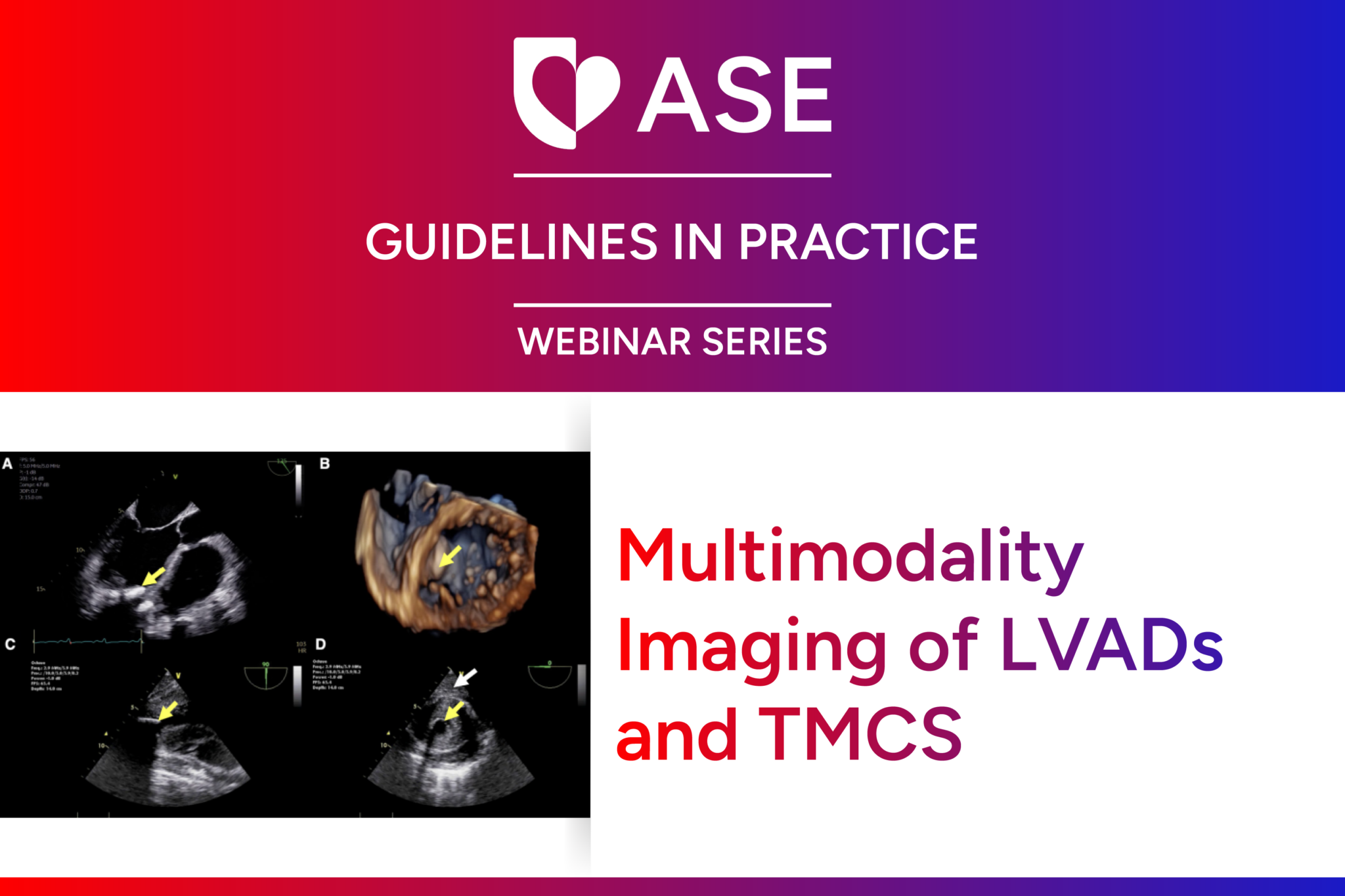 Guidelines In Practice Webinar Series: Multimodality Imaging of LVADs and TMCS