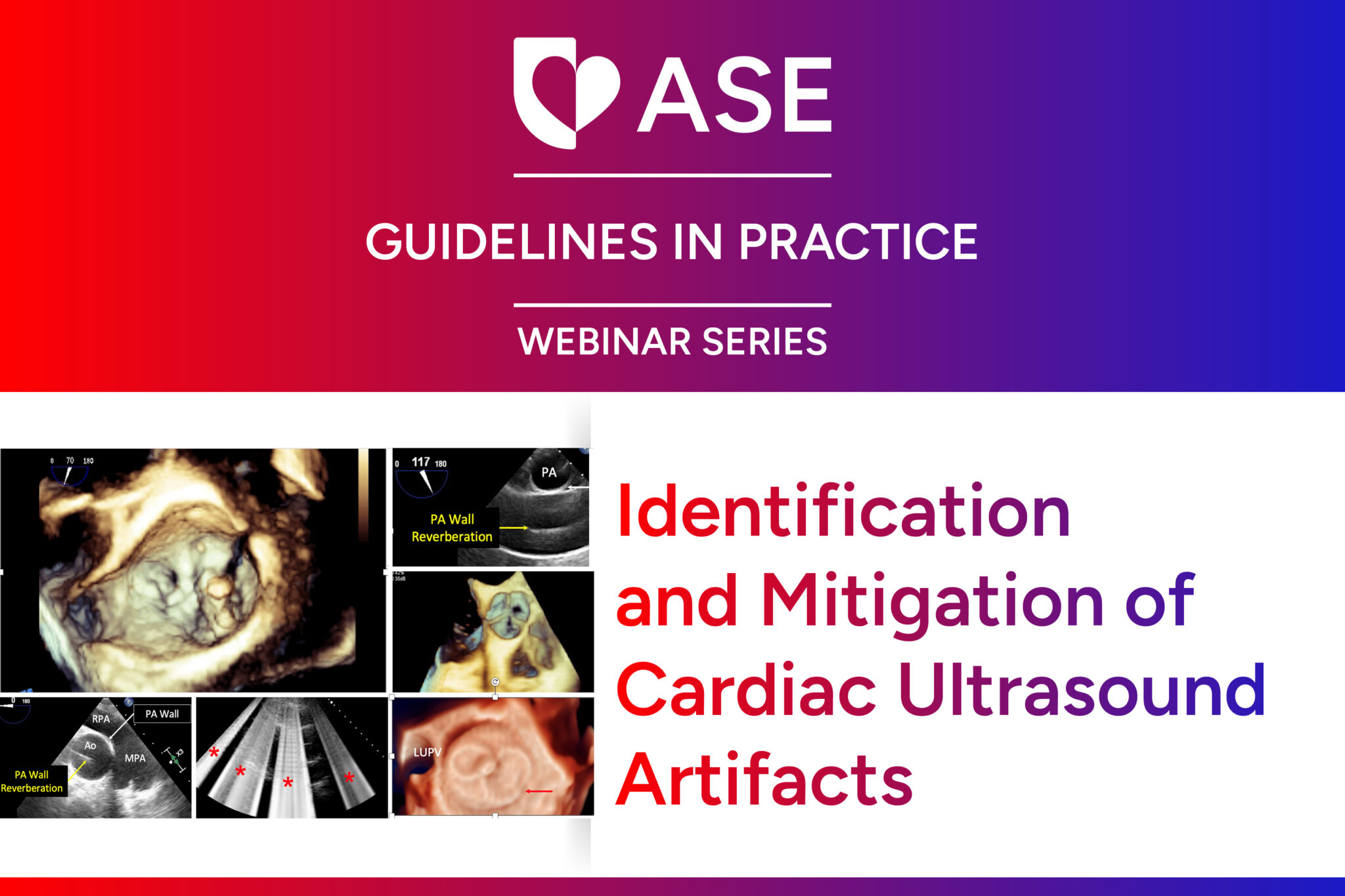 Guidelines In Practice Webinar Series: Ultrasound Artifacts