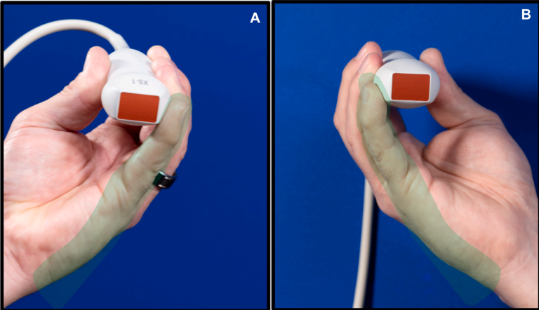 Probe Grips